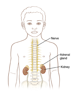 Neuroblastoma may be found in the adrenal glands and paraspinal nerve tissue from the neck to the pelvis.