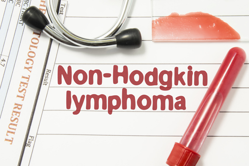 Childhood Non-Hodgkin Lymphoma Cancer