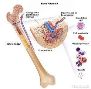 Causes Childhood Leukemia bones